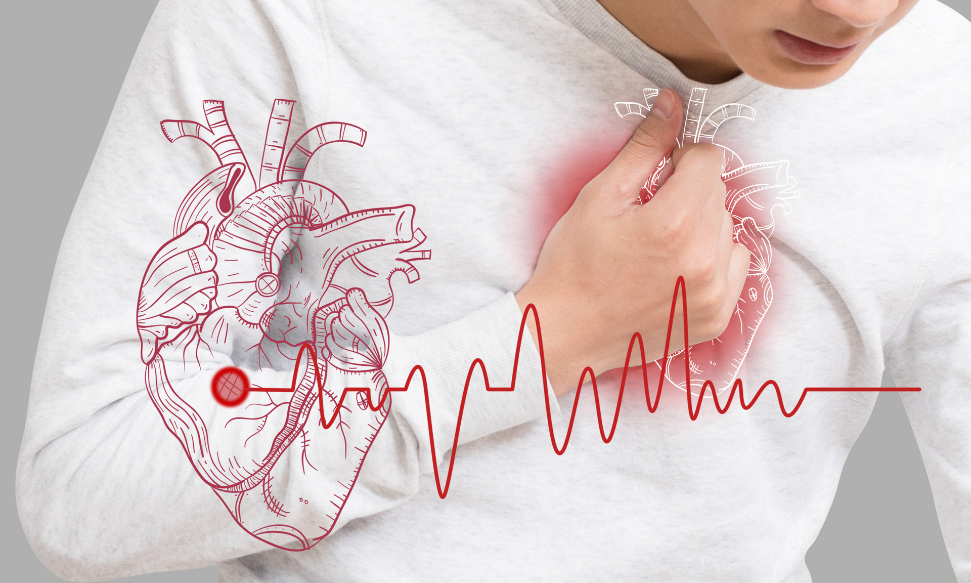 五类急性心肌梗塞常见并发症以及预防措施