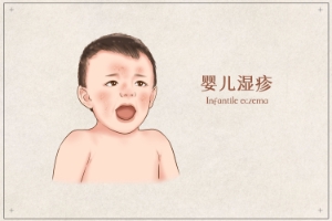 湿疹和荨麻疹究竟有什么样的差别呢？