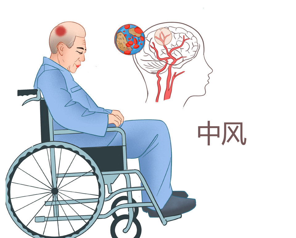 轻微脑中风,重疾险